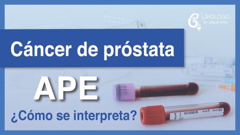 Comparativa de precios del ant&iacute;geno prost&aacute;tico en farmacias similares