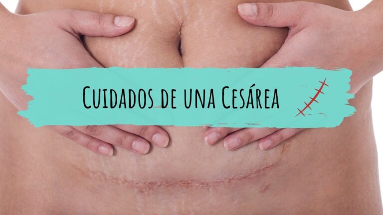 La posibilidad de abrir una ces&aacute;rea desde adentro: &iquest;Es factible?